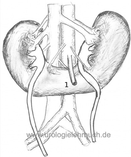 Abbildung schematische Zeichnung einer Hufeisenniere