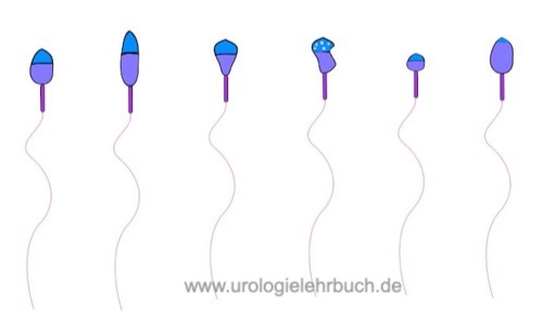 Spermiogramm: Ablauf, Auswertung, Diagnose & Kosten